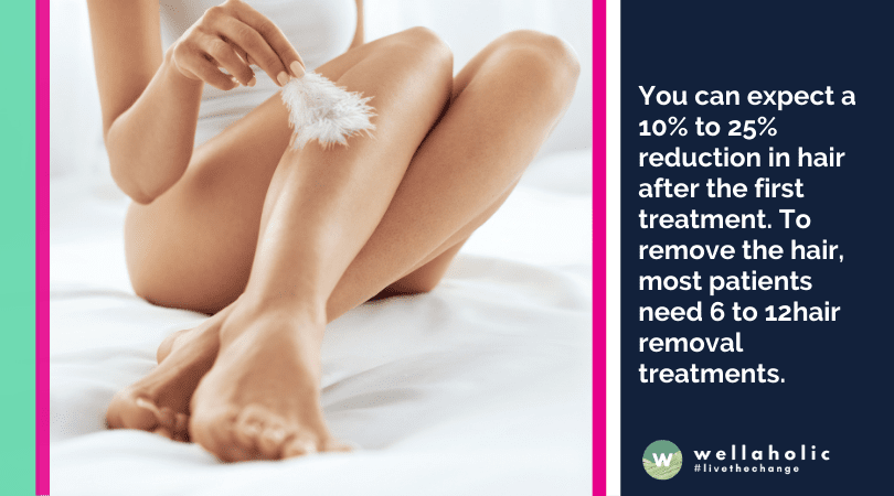 You can expect a 10% to 25% reduction in hair after the first treatment. To remove the hair, most patients need 6 to 12hair removal treatments.