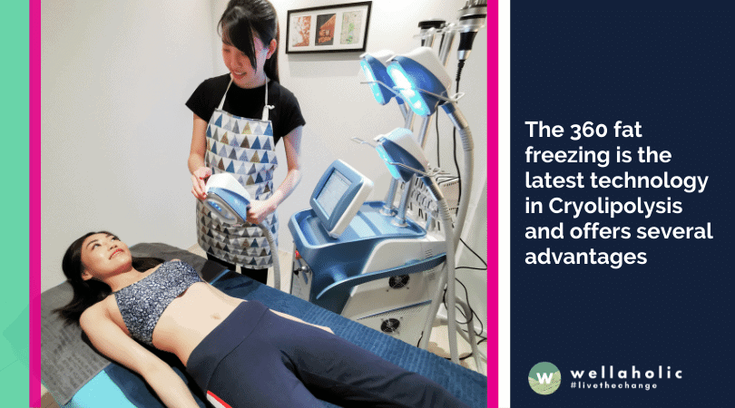 The 360 fat freezing is the latest technology in Cryolipolysis and offers several advantages