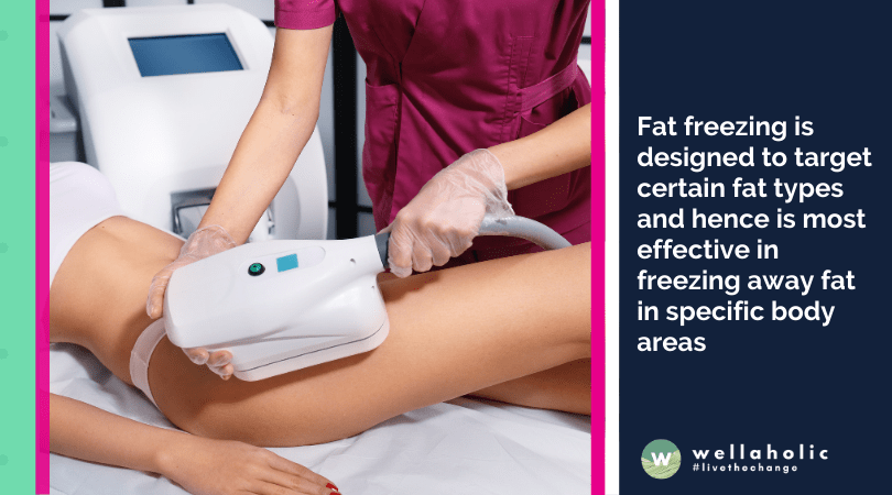 Fat freezing is designed to target certain fat types and hence is most effective in freezing away fat in specific body areas