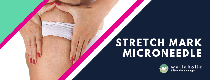 Wellaholic Service Headers - Stretch Mark Microneedle