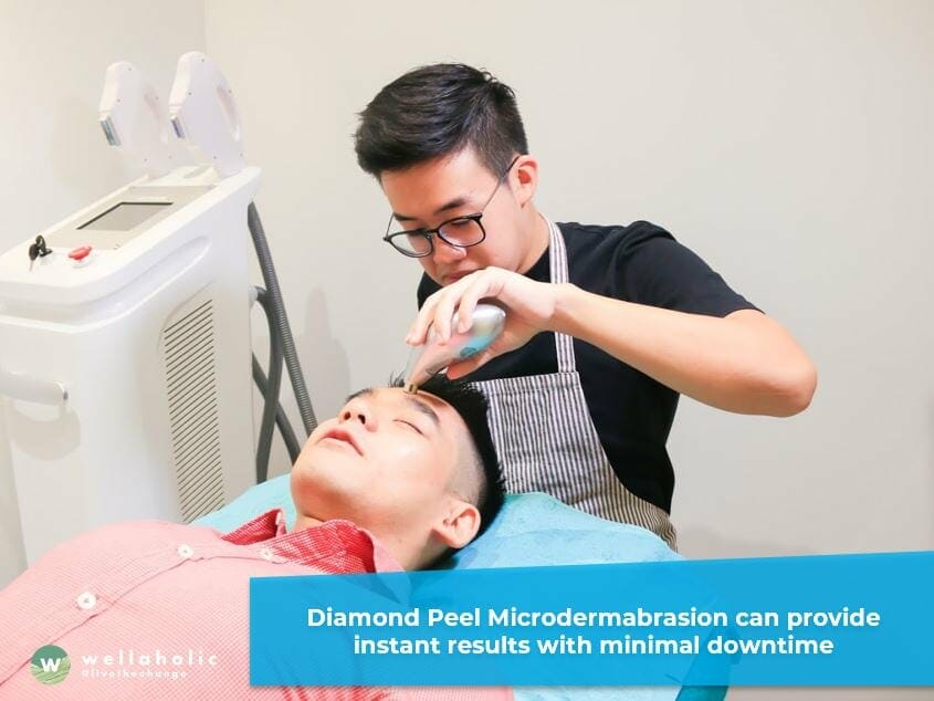 What are the Benefits of Diamond Peel?