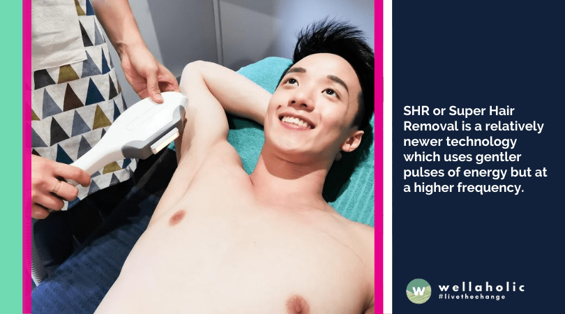 SHR or Super Hair Removal