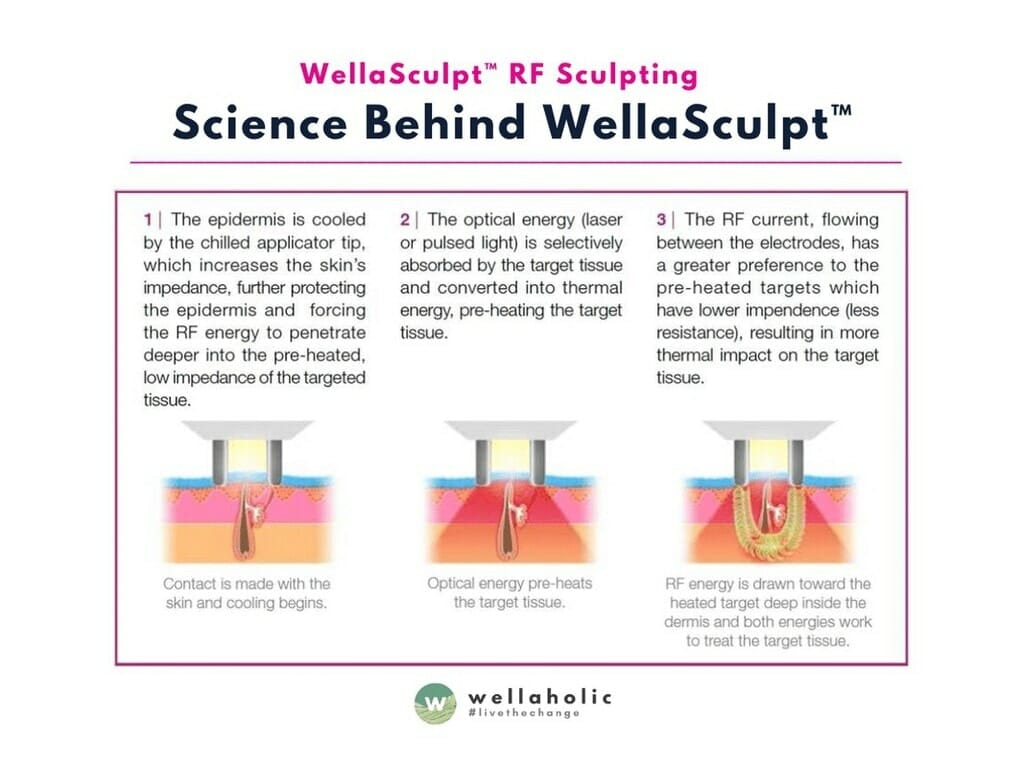 Science behind WellaSculpt