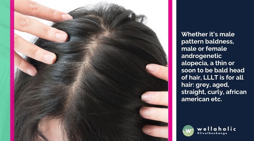 How do I know if My Hair Loss is due to Main Pattern Baldness