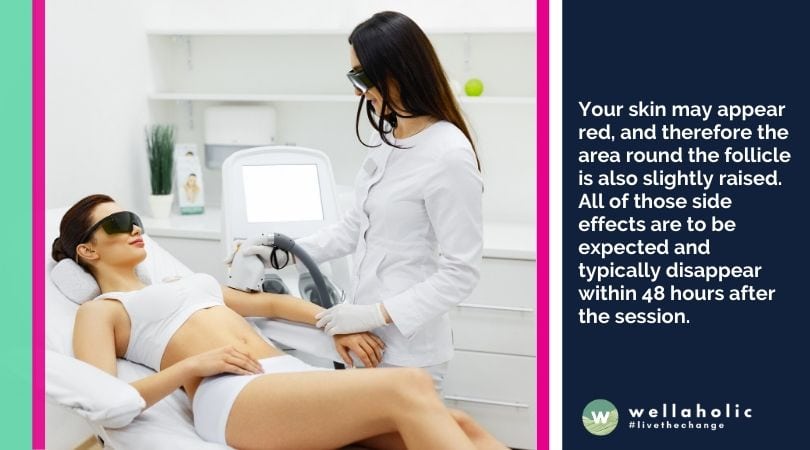 Post Care Hair Removal